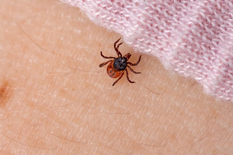 Identifying Ticks and Tick Bites | Tick Bite vs Spider Bite